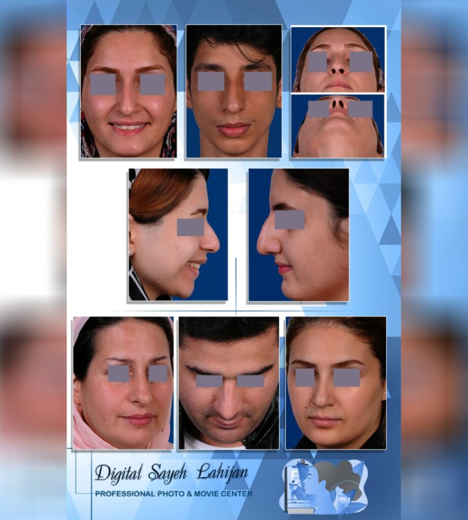 عکاسی پزشکی سایه در لاهیجان